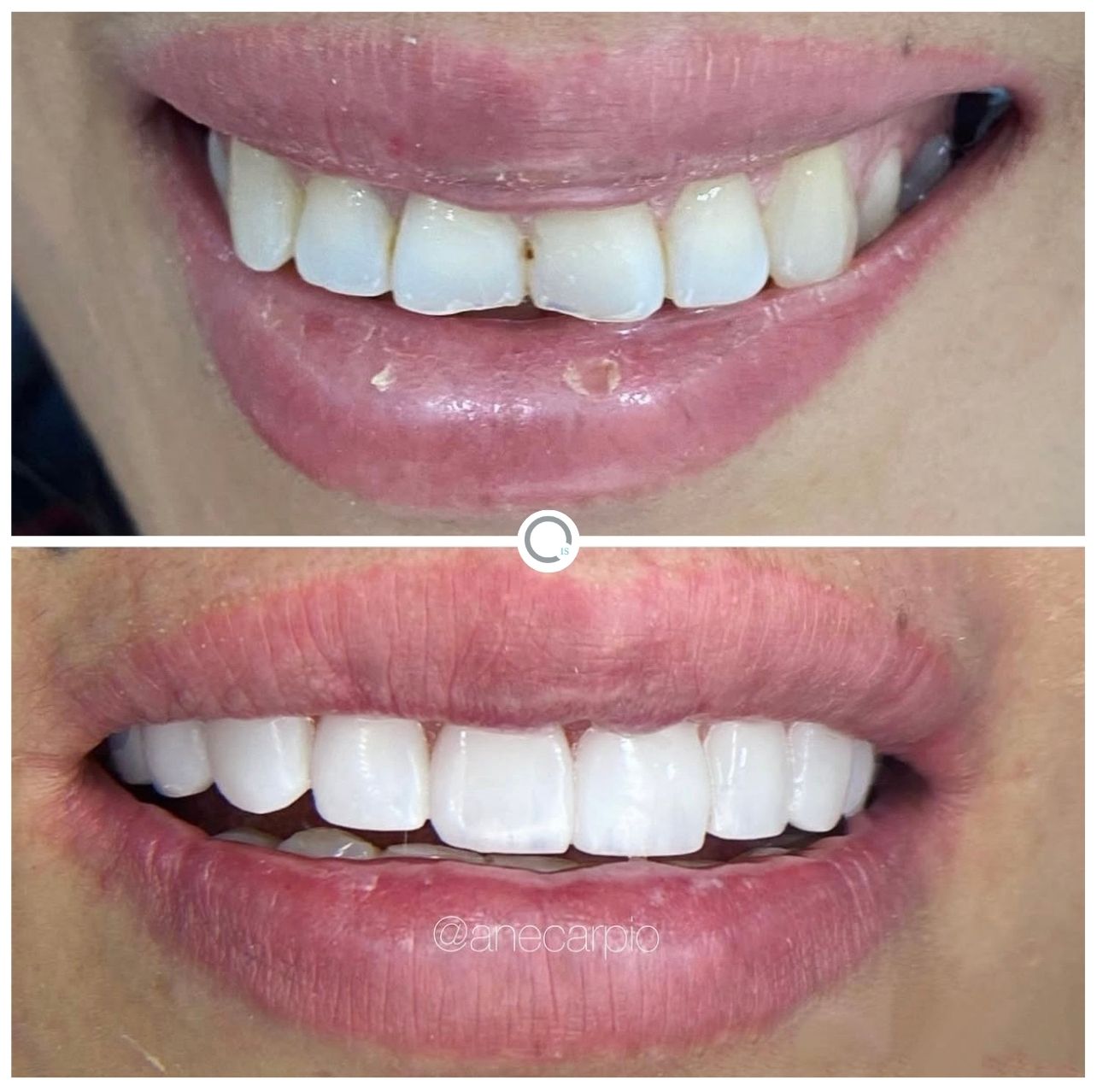 Caso de Éxito 2 - Implants & Smiles